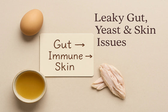 Editorial flat-lay of whole-food ingredients—egg, broth, soft cooked protein—and a kraft card labeled ‘Gut → Immune → Skin’ on a beige background with the title ‘Leaky Gut, Yeast & Skin Issues’ in Natty Nootz’s premium style.